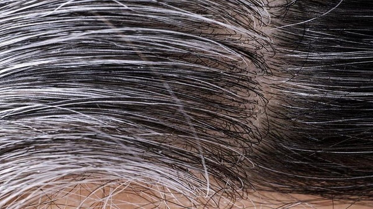Genetikten strese: Saçlarınızın beyazlamasının nedenleri 