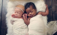 Farklı ten renklerine sahip olan ikiz bebekler
