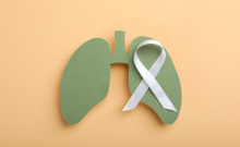 Sağlığınız için harekete geçin! Akciğer kanserine erken teşhis…