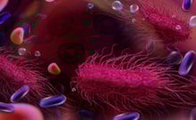 Salmonella'dan korunmanın 5 yolu