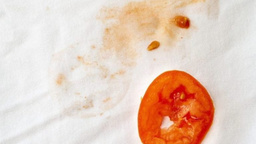 Çoğumuzun korkulu rüyasıydı ama basit bir yöntemi varmış! Zorlu domates lekeleri nasıl çıkar?