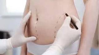 Kalça ve basendeki yağlardan liposuction ile kurtulun