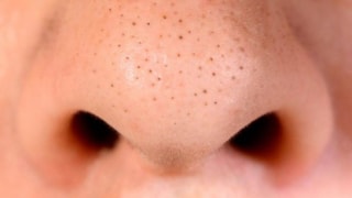 Geniş gözeneklere elveda! Pürüzsüz bir cilt için 7 yöntem