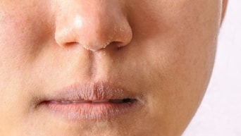 Yanlış ürünler cildinizi kurutuyor olabilir! İşte doğru seçimler!