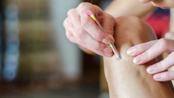 Jilet ve Peelinge Veda: Bu Tuz Batık Kılları Söküp Atıyor!