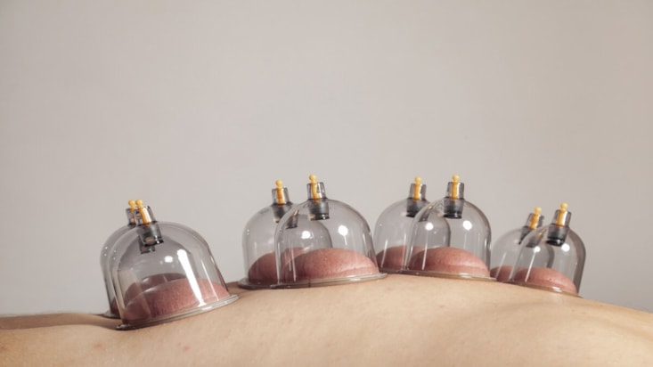 Ocak ayının hacamat günleri